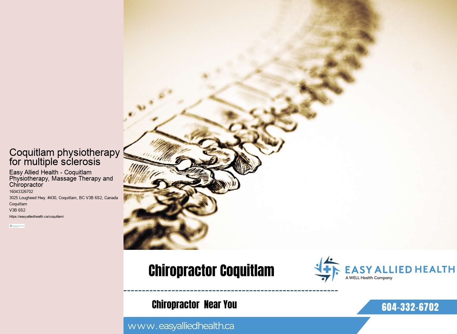 Coquitlam physiotherapy for car accident injuries