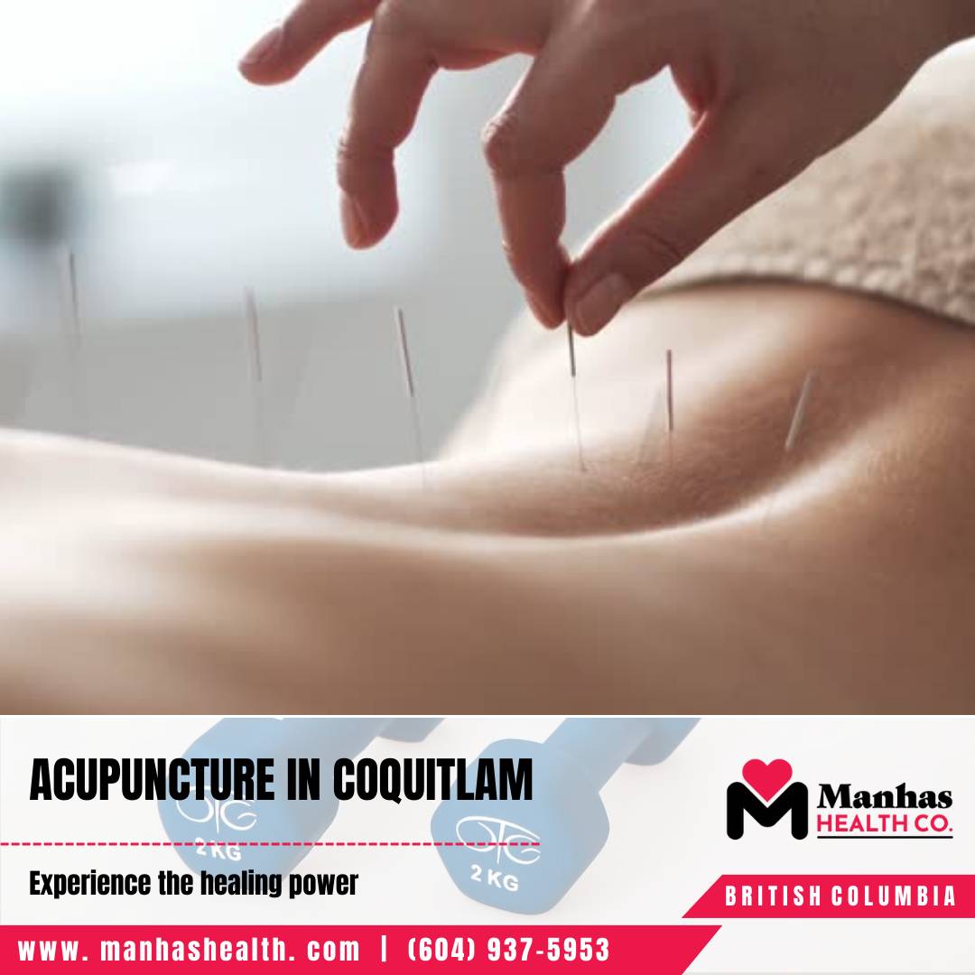 Physiotherapy Center Coquitlam Physiotherapy for Joint Pain
