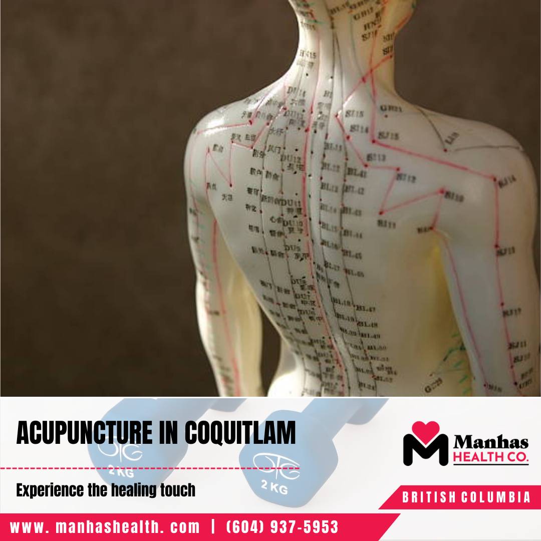 Neurological Physiotherapy Services Coquitlam Top Physiotherapists